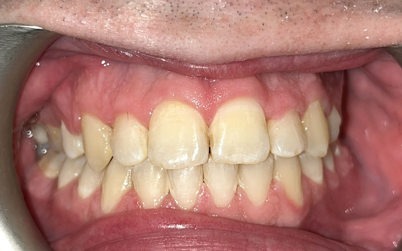 After Image