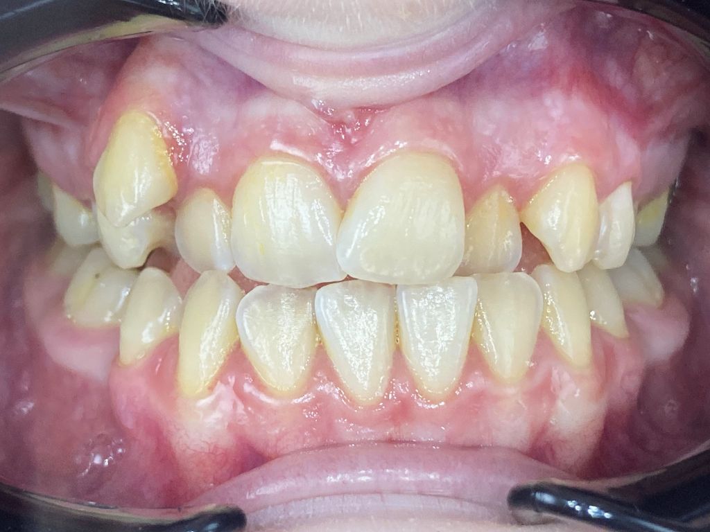 Before Image
