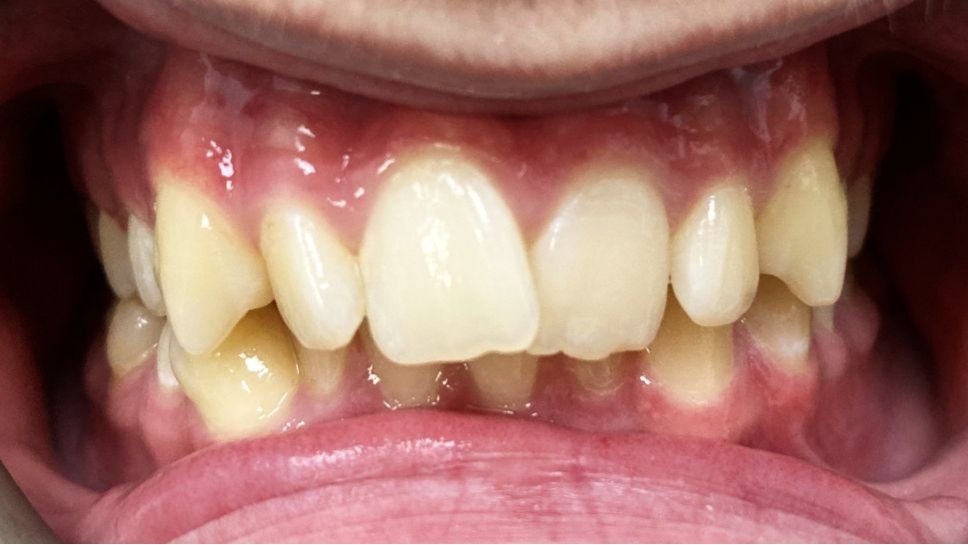 Before Image