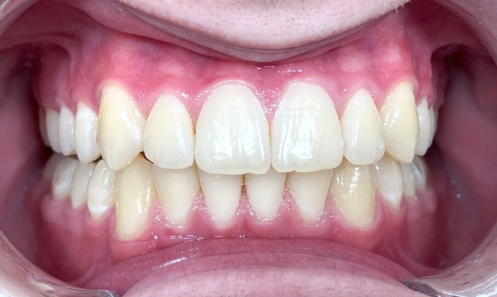 After Image
