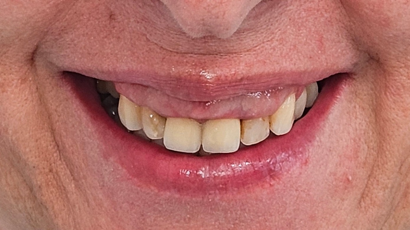 Before Image